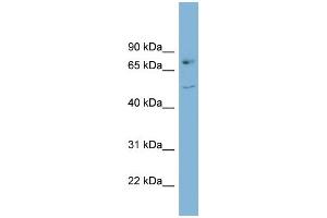 WB Suggested Anti-AADAT Antibody Titration:  0. (AADAT Antikörper  (Middle Region))