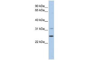 DHRS1 antibody used at 1 ug/ml to detect target protein. (DHRS1 Antikörper)
