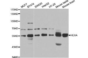 Western blot analysis of extracts of various cell lines, using HEXA antibody (ABIN5973292) at 1/1000 dilution. (Hexosaminidase A Antikörper)