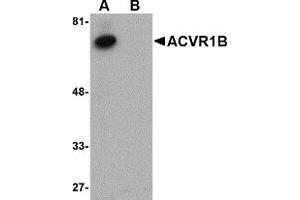 Western Blotting (WB) image for anti-Activin A Receptor, Type IB (ACVR1B) (C-Term) antibody (ABIN1030218) (Activin A Receptor Type IB/ALK-4 Antikörper  (C-Term))