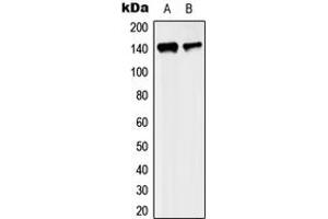 Western blot analysis of KIF4A expression in MCF7 (A), SP2/0 (B) whole cell lysates. (KIF4A Antikörper  (C-Term))