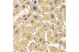 Immunohistochemistry of paraffin-embedded Human liver injury using KIF1B antibody at dilution of 1:100 (x400 lens). (KIF1B Antikörper)