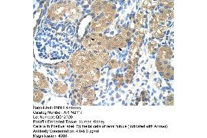 Rabbit Anti-TNNI1 Antibody  Paraffin Embedded Tissue: Human Kidney Cellular Data: Epithelial cells of renal tubule Antibody Concentration: 4.