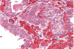 Immunohistochemistry (IHC) image for anti-Tropomyosin 4 (TPM4) (C-Term) antibody (ABIN2613490)