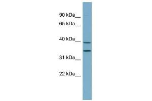 PRKAB1 antibody used at 1 ug/ml to detect target protein. (PRKAB1 Antikörper  (N-Term))