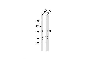 Western Blot at 1:1000 dilution Lane 1: Caco2 whole cell lysate Lane 2: KG-1 whole cell lysate Lysates/proteins at 20 ug per lane. (G-CSF Antikörper  (AA 252-280))
