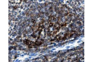 IHC analysis of CD74 using anti-CD74 antibody (ABIN7603166). (CD74 Antikörper  (N-Term))