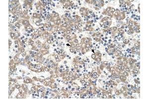 KYNU antibody was used for immunohistochemistry at a concentration of 4-8 ug/ml to stain Hepatocytes (arrows) in Human Liver. (KYNU Antikörper)