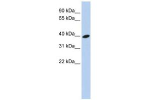 ARL13B antibody used at 1 ug/ml to detect target protein.