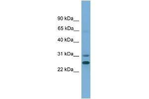 WB Suggested Anti-DHRS2 Antibody Titration:  0. (DHRS2 Antikörper  (N-Term))