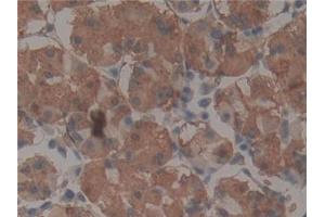 Immunohistochemistry (IHC) image for anti-Telomerase-Associated Protein 1 (TEP1) (AA 2368-2627) antibody (ABIN7432034)