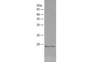 Western Blotting (WB) image for Proline-Rich Protein HaeIII Subfamily 1 (PRH1) (AA 17-122) protein (His tag) (ABIN7124595) (PRH1 Protein (AA 17-122) (His tag))