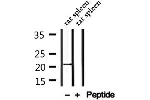 Western Blotting (WB) image for anti-Cancer/testis Antigen 2 (CTAG2) (Internal Region) antibody (ABIN6261074)