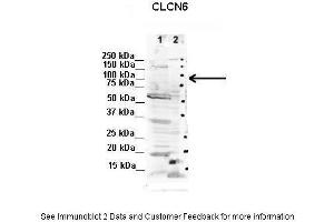Lanes:   1. (CLCN6 Antikörper  (C-Term))