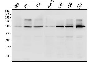 Western blot analysis of R Cadherin/CDH4 using anti-R Cadherin/CDH4 antibody (ABIN6719392).
