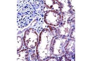 Immunohistochemistry analysis in formalin fixed and paraffin embedded human kidney tissue reacted with Interleukin-6 (IL6) Antibody (Center) followed by peroxidase conjugation of the secondary antibody and DAB staining. (IL-6 Antikörper  (Middle Region))