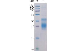 Human HVEM Protein, His Tag on SDS-PAGE under reducing condition.