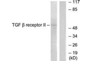 Western Blotting (WB) image for anti-Transforming Growth Factor, beta Receptor II (70/80kDa) (TGFBR2) (AA 91-140) antibody (ABIN2889260) (TGFBR2 Antikörper  (AA 91-140))