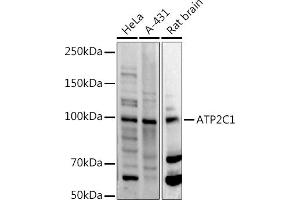 Western blot analysis of extracts of various cell lines, using C1 antibody (ABIN3016169, ABIN3016170, ABIN3016171 and ABIN6219598) at 1:500 dilution. (ATP2C1 Antikörper  (AA 400-660))