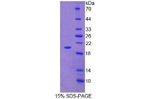 SDS-PAGE analysis of Rat Tenascin C Protein. (TNC Protein)