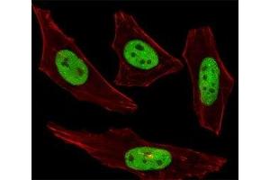 Fluorescent image of HeLa cells stained with SUMO2/3 antibody was diluted at 1:100 dilution. (SUMO2/3 Antikörper  (AA 49-81))