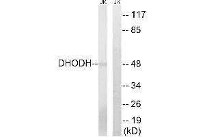 Immunohistochemistry analysis of paraffin-embedded human lung carcinoma tissue, using DHODH antibody. (DHODH Antikörper  (Internal Region))