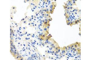 Immunohistochemistry of paraffin-embedded Mouse lung using FECH Polyclonal Antibody at dilution of 1:100 (40x lens). (FECH Antikörper)