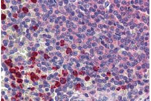 Immunohistochemistry (Formalin-fixed Paraffin-embedded Sections) (IHC (fp)) image for anti-C-Type Lectin Domain Family 2, Member D (CLEC2D) (AA 1-155) antibody (ABIN790667)