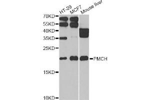 Western blot analysis of extracts of various cell lines, using PMCH antibody (ABIN2564591) at 1:1000 dilution.