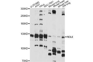 Western blot analysis of extracts of various cell lines, using NOL6 antibody (ABIN6290704) at 1:1000 dilution. (Nucleolar Protein 6 Antikörper)