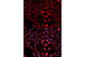 Immunofluorescence analysis of HeLa cell using PKM antibody. (PKM2 Antikörper)