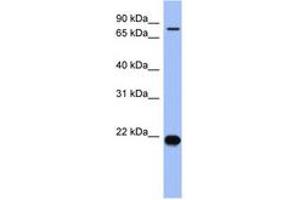 Image no. 1 for anti-Zinc Finger Protein 800 (ZNF800) (N-Term) antibody (ABIN6742935) (ZNF800 Antikörper  (N-Term))