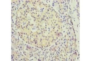 Immunohistochemistry of paraffin-embedded human pancreatic tissue using ABIN7157660 at dilution of 1:100 (KIFC3 Antikörper  (AA 140-390))