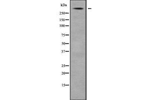 Western blot analysis USP24 using Jurkat whole cell lysates (USP24 Antikörper  (Internal Region))
