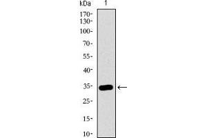 Western blot analysis using MAPK14 mAb against human MAPK14 recombinant protein. (MAPK14 Antikörper  (AA 299-360))