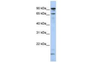 Image no. 1 for anti-Male-Specific Lethal 2 Homolog (MSL2) (N-Term) antibody (ABIN6740807) (MSL2 Antikörper  (N-Term))