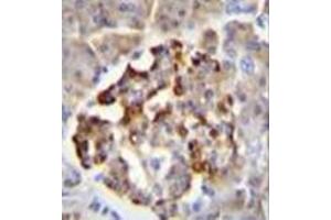 Immunohistochemistry analysis in formalin fixed and paraffin embedded human pancreas tissue reacted with GAD2 / GAD65 Antibody (Center) followed by peroxidase conjugation of the secondary antibody and DAB staining. (GAD65 Antikörper  (Middle Region))