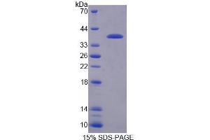 SDS-PAGE analysis of Mouse RGS9 Protein. (RGS Protein)