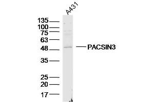 A431 lysates probed with PACSIN3 Polyclonal Antibody, Unconjugated  at 1:300 dilution and 4˚C overnight incubation. (PACSIN3 Antikörper  (AA 251-350))