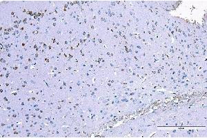 IHC analysis of RALBP1 using anti-RALBP1 antibody (ABIN7600800). (RALBP1 Antikörper  (AA 239-506))