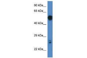 WB Suggested Anti-Gal3st4 Antibody   Titration: 1.