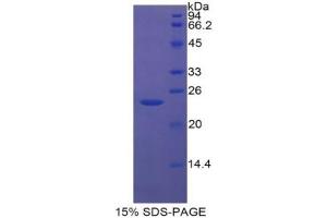 SDS-PAGE analysis of Rat Insulin Like Growth Factor Binding Protein 6 (IGFBP6) Protein. (IGFBP6 Protein)