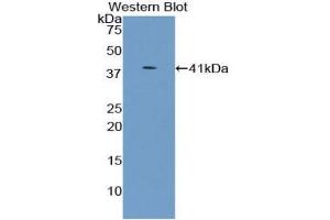 Western blot analysis of the recombinant protein. (UGT8 Antikörper  (AA 198-541))