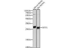Western blot analysis of extracts of various cell lines, using GSTZ1 antibody (ABIN6132376, ABIN6141485, ABIN6141486 and ABIN6221727) at 1:500 dilution. (GSTZ1 Antikörper  (AA 1-216))