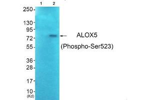 Western blot analysis of extracts from JK cells (Lane 2), using ALOX5 (Phospho-Ser523) Antibody. (ALOX5 Antikörper  (pSer523))