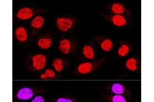 Confocal immunofluorescence analysis of U-2 OS cells using TEAD3 Polyclonal Antibody at dilution of 1:400. (TEAD3 Antikörper)