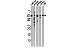 The anti-Drosophila Parkin Pab (ABIN390387 and ABIN2850546) is used in Western blot to detect Drosophila Parkin in, from left to right, mouse kidney, mouse brain, mouse heart, Ramos, and Hela tissue lysates. (Parkin Antikörper  (N-Term))