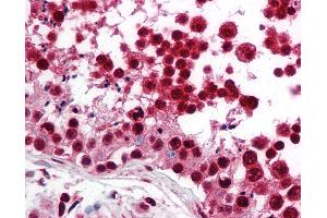 Immunohistochemistry (IHC) image for anti-Sterol Regulatory Element Binding Transcription Factor 2 (SREBF2) (AA 455-469) antibody (ABIN2451790)
