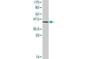 Western Blot detection against Immunogen (46. (RAC2 Antikörper  (AA 1-192))