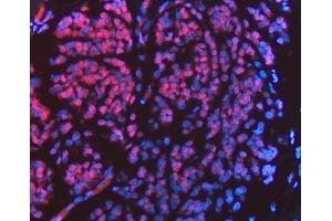 IF analysis of FIP1L1 using anti-FIP1L1 antibody (ABIN7600761). (FIP1L1 Antikörper  (AA 23-558))